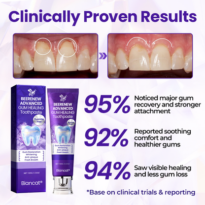 Big Sale 50% - HoneyHeal Natural Gum Protection Toothpaste