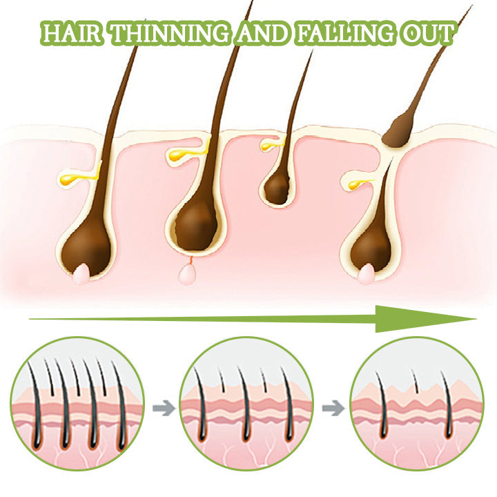 Holiday Sale 50%🚀Biancat PurePulse Jamaican Black Castor Oil